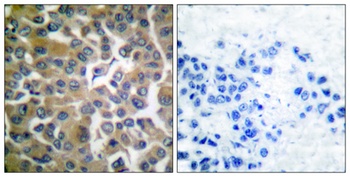 Seprase antibody