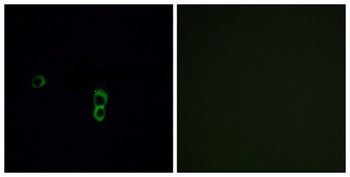 Olfactory receptor 9Q1 rabbit pAb
