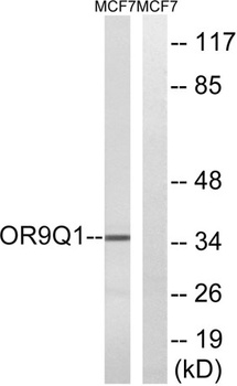 Olfactory receptor 9Q1 antibody