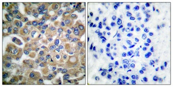 FBN1 rabbit pAb Antibody