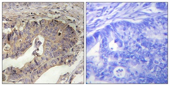 FBN1 rabbit pAb Antibody