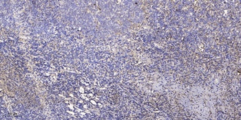 CD32b antibody