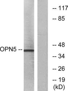 Neuropsin antibody