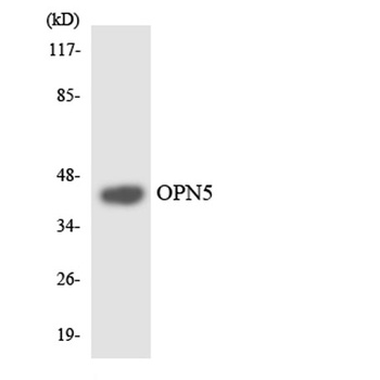 Neuropsin antibody