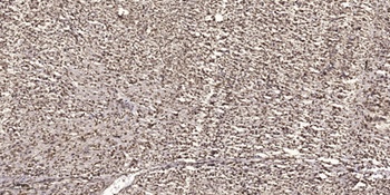 FoxK1 rabbit pAb