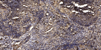 ZNRF2 rabbit pAb