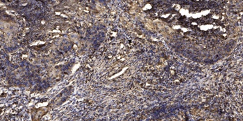 ZNRF2 antibody