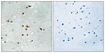 Fer (phospho Tyr402) rabbit pAb