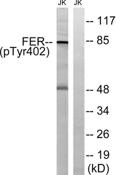 Fer (phospho Tyr402) rabbit pAb