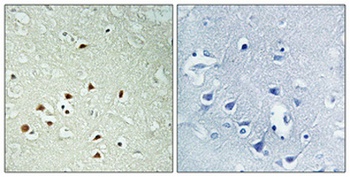 ERK 8 (phospho-Thr175/Y177) antibody