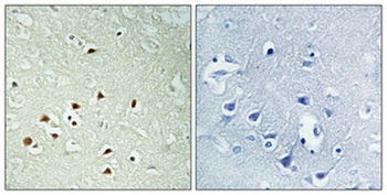 ERK 8 (phospho Thr175/Y177) rabbit pAb