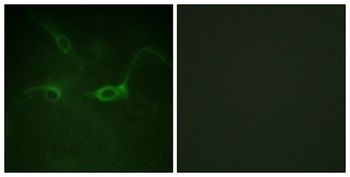 Flg (phospho-Tyr654) antibody