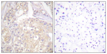 Flg (phospho Tyr766) rabbit pAb