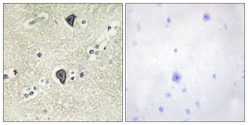 FGFR-3 rabbit pAb