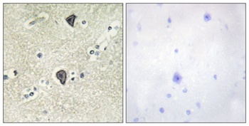 FGFR-3 antibody