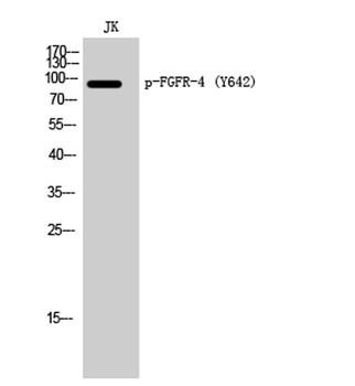 FGFR-4 (phospho Tyr642) rabbit pAb