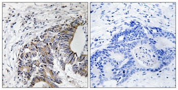 Fhit (phospho Tyr114) rabbit pAb