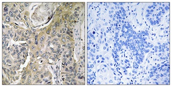 RHOBTB3 antibody