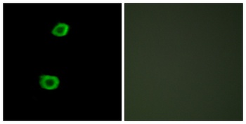 KPI-2 antibody