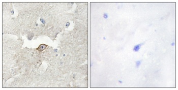 KPI-2 rabbit pAb