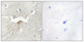 KPI-2 antibody