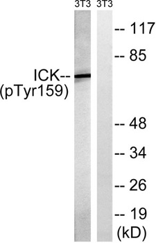 Intestinal Cell Kinase (phospho-Tyr159) antibody