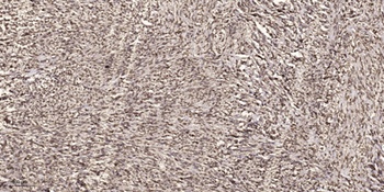 Intestinal Cell Kinase rabbit pAb