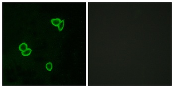 Latrophilin-1 rabbit pAb Antibody