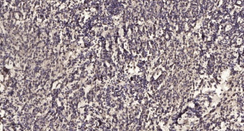 Latrophilin-1 rabbit pAb