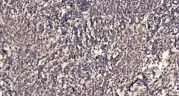 Latrophilin-1 antibody