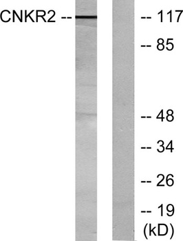 CNK2 antibody