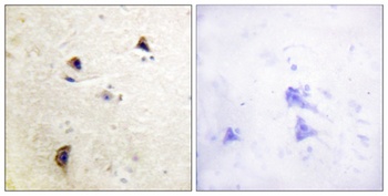 Rabphilin-3A (phospho-Ser237) antibody