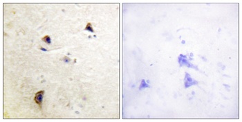 Rabphilin-3A (phospho Ser237) rabbit pAb