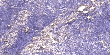 Shank 2 antibody