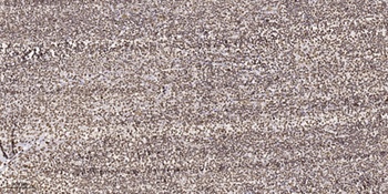 FoxC1/2 rabbit pAb