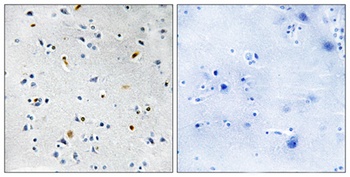 TPX2 antibody