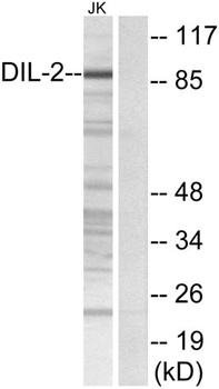 TPX2 antibody