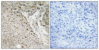 FoxE3 antibody