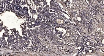 NDR2 antibody