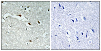 FoxJ1 antibody