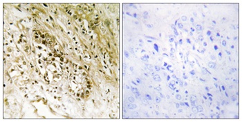 PDZK3 rabbit pAb Antibody