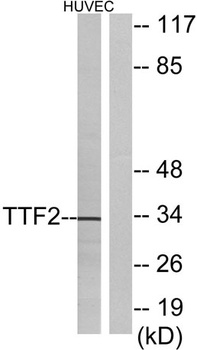 FoxE1 antibody