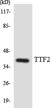 FoxE1 antibody