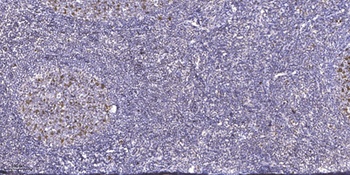 FoxE1 antibody