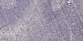 FoxO1/3 (phospho-Ser322/S325) antibody