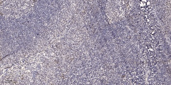 FoxO1/3 (phospho Ser322/S325) rabbit pAb