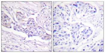 FoxO1A (phospho Ser329) rabbit pAb