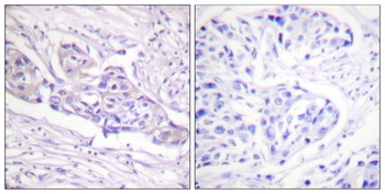 FoxO1A (phospho-Ser329) antibody