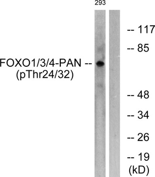 FoxO1/3/4 (phospho-Thr24/32) antibody