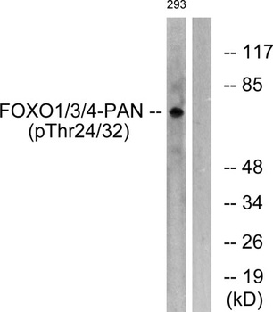 FoxO1/3/4 (phospho Thr24/32) rabbit pAb